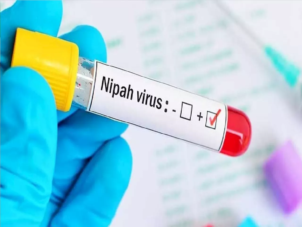 आधी मंकीपॉक्स आता Nipah Virus चा धोका, देशात 24 वर्षांच्या तरुणाचा मृत्यू... , वेळीच ही लक्षणं ओळखा?