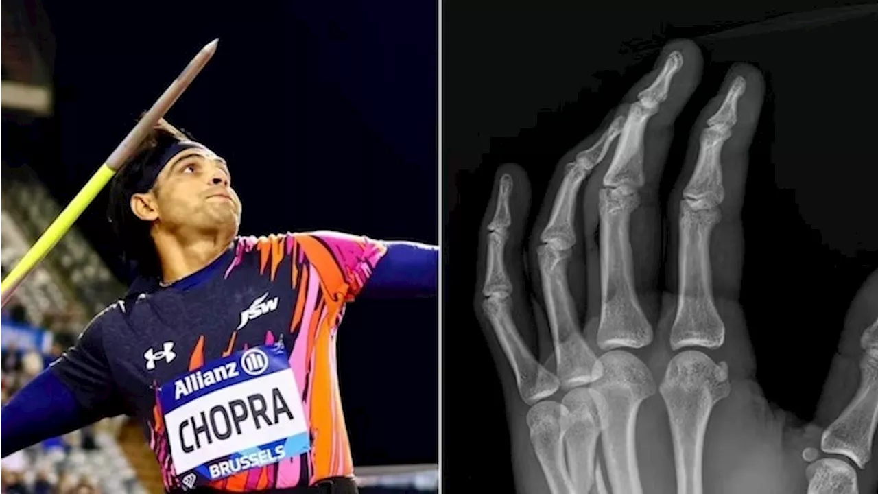 Neeraj Chopra Undergoes Surgery: गोल्डन बॉय नीरज चोपड़ा की सफल सर्जरी... टूटे हाथ के साथ खेली थी डायमंड लीग