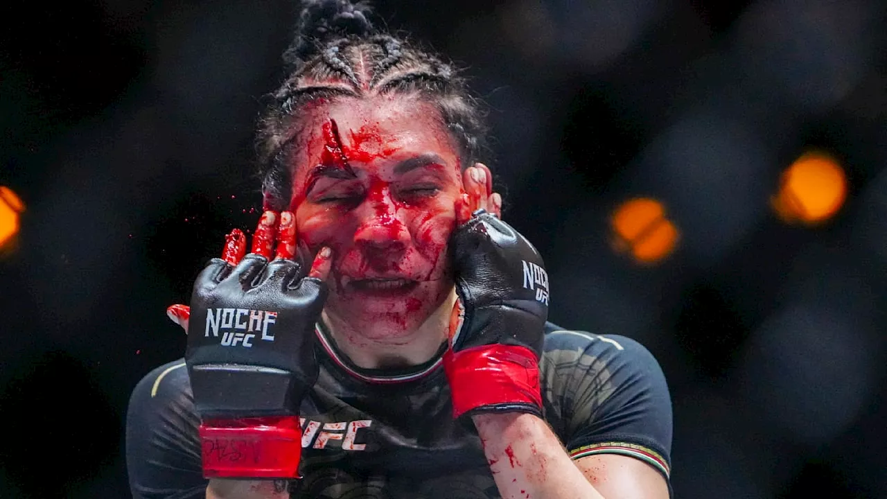 UFC-Kämpferin Aldana trotz brutaler Verletzungen gut gelaunt