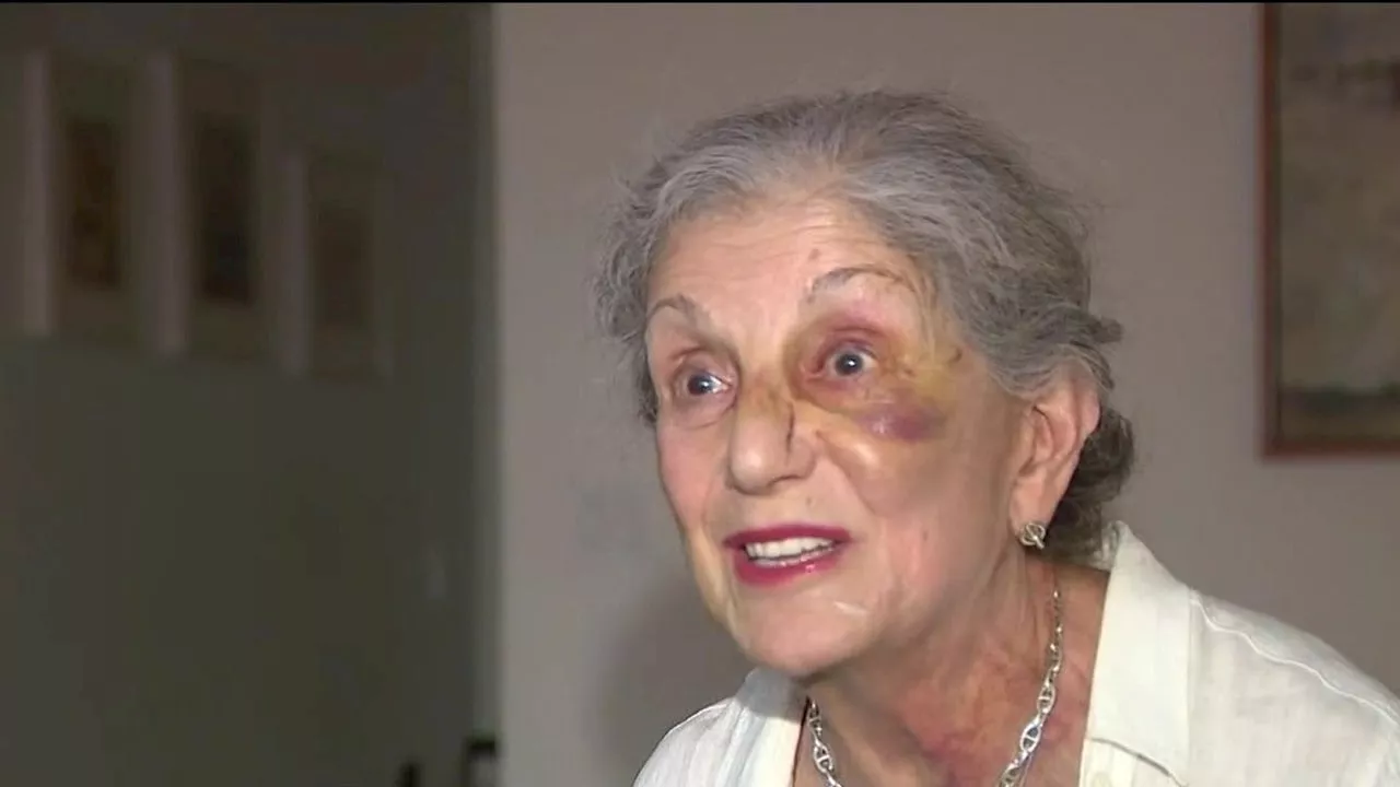 81-Year-Old Woman Speaks Out After Random Attack on Upper West Side