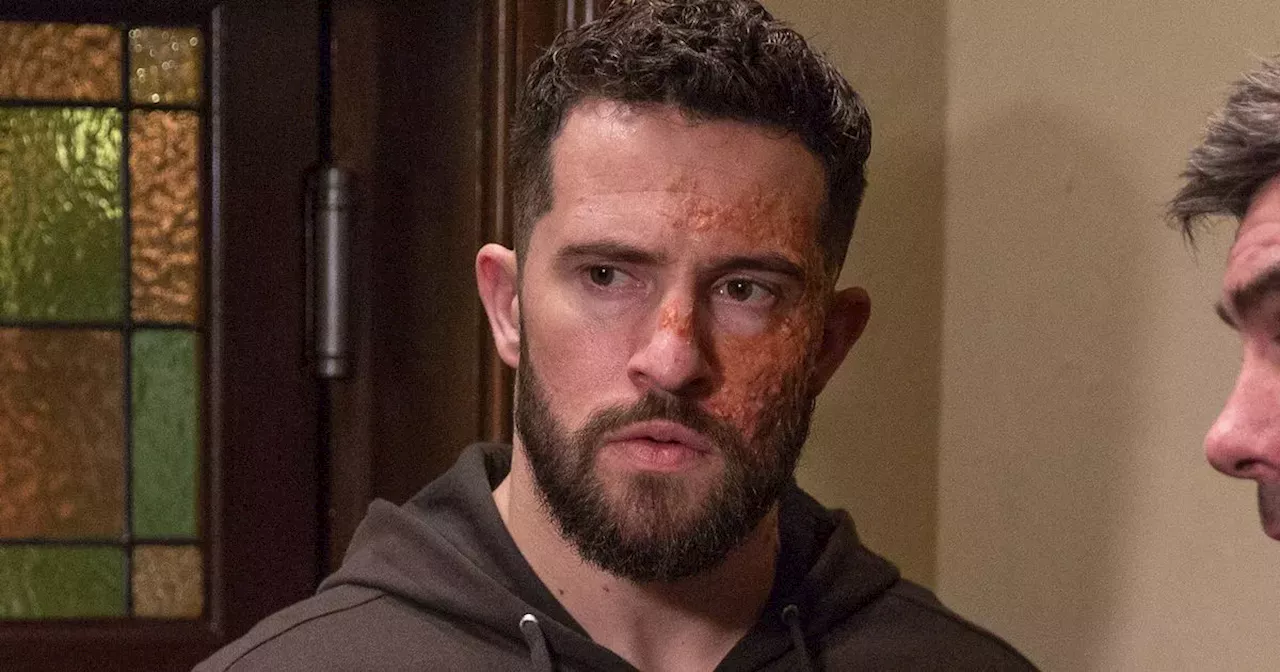 ITV Emmerdale Ross Barton return confirmed as Michael Parr teases 'fireworks'