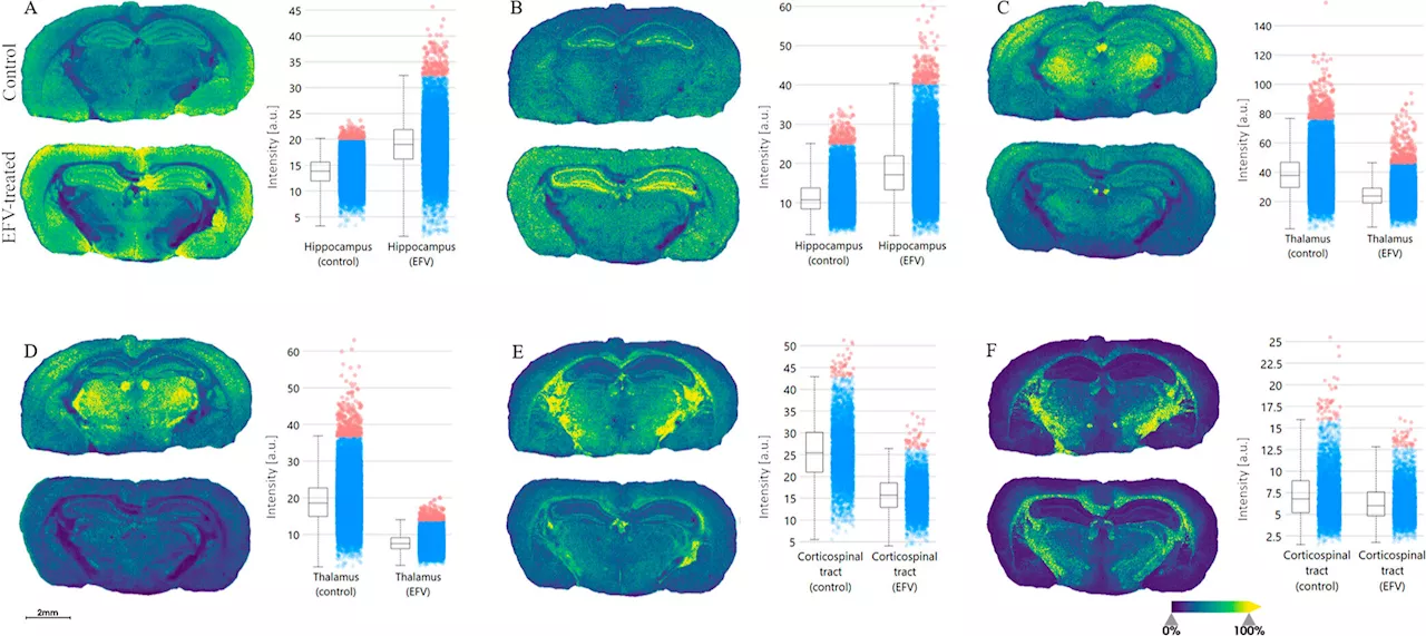 New study increases understanding of HIV drug's negative effects on the brain