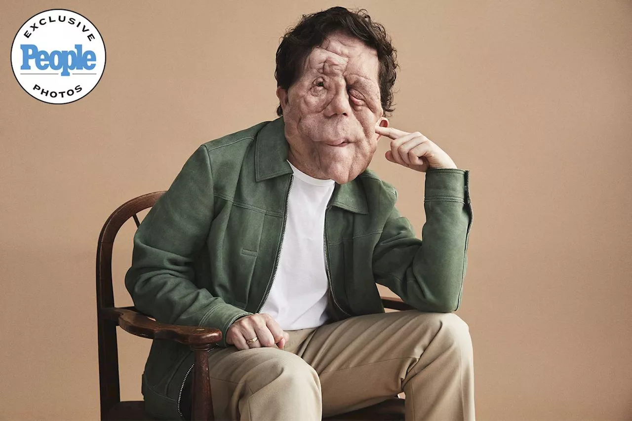 'A Different Man' Star Adam Pearson Says His Facial Disfigurement 'Opened Doors' (Exclusive)