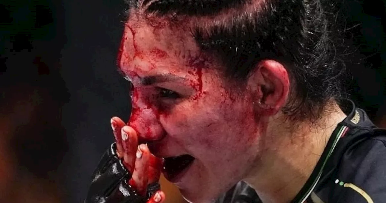 Imágenes sensibles: la luchadora Irene Aldana y sus graves heridas en un combate de la UFC