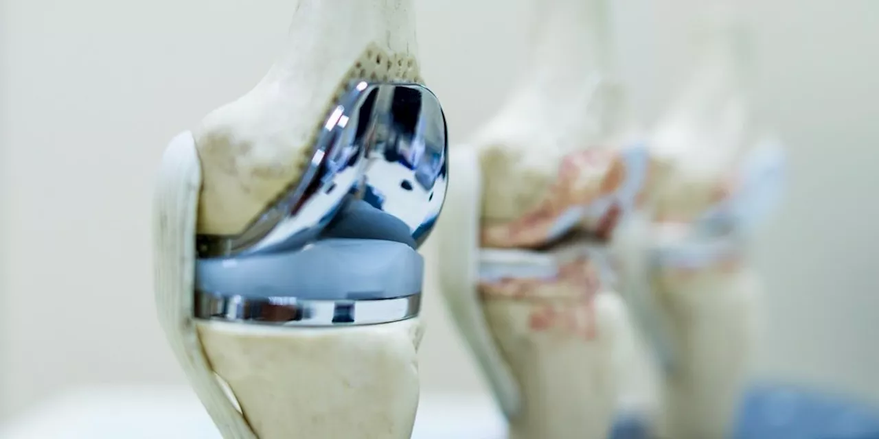 New Treatment Approach May Delay a Knee Replacement