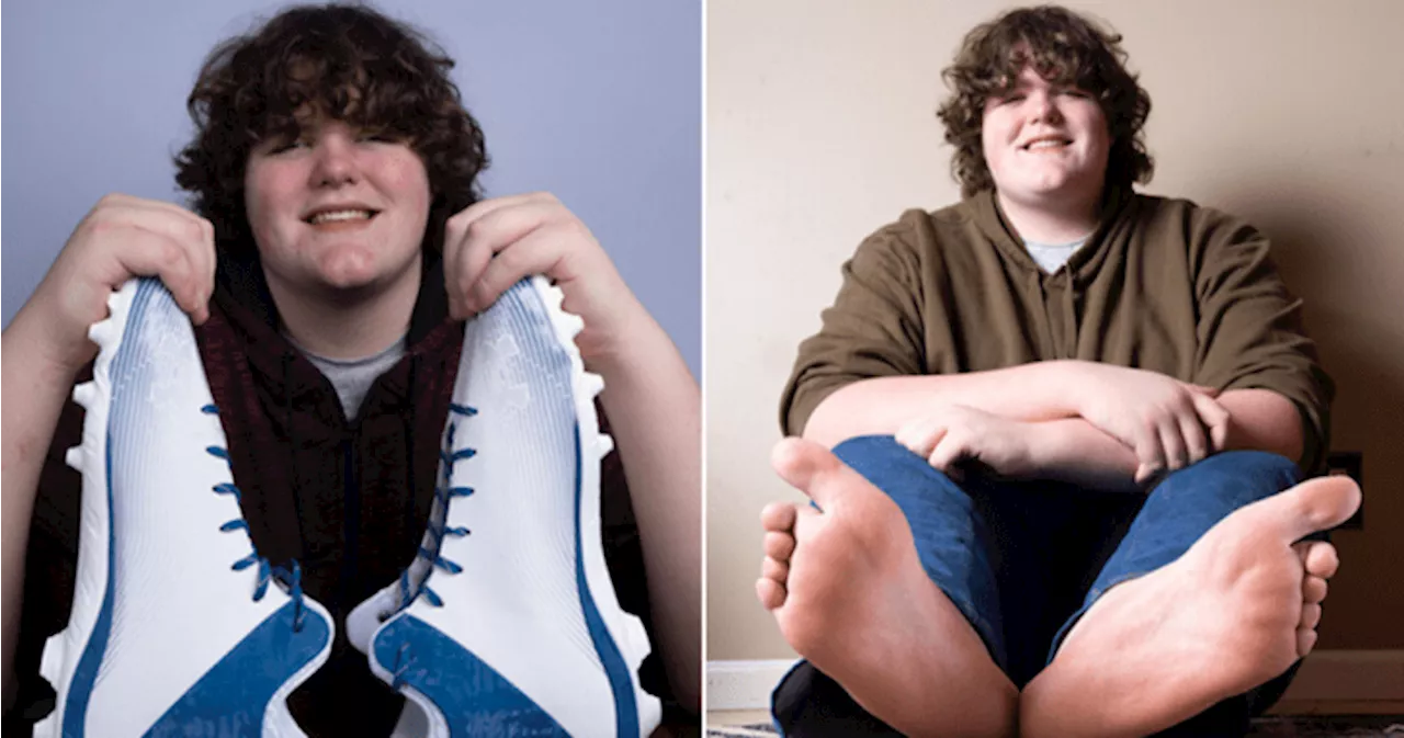 Teen who desperately needed size 23 shoes now holds 2 world records