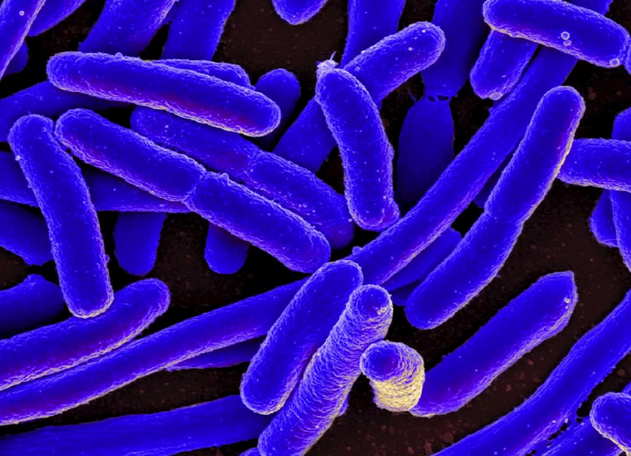 Antibiotikaresistens vil koste 40 millioner liv frem mod 2050