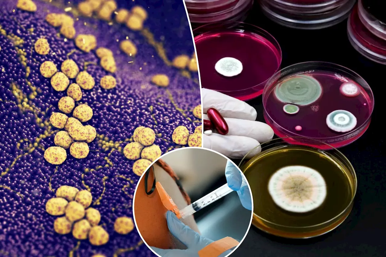 Superbug crisis will likely kill millions by 2050, study finds