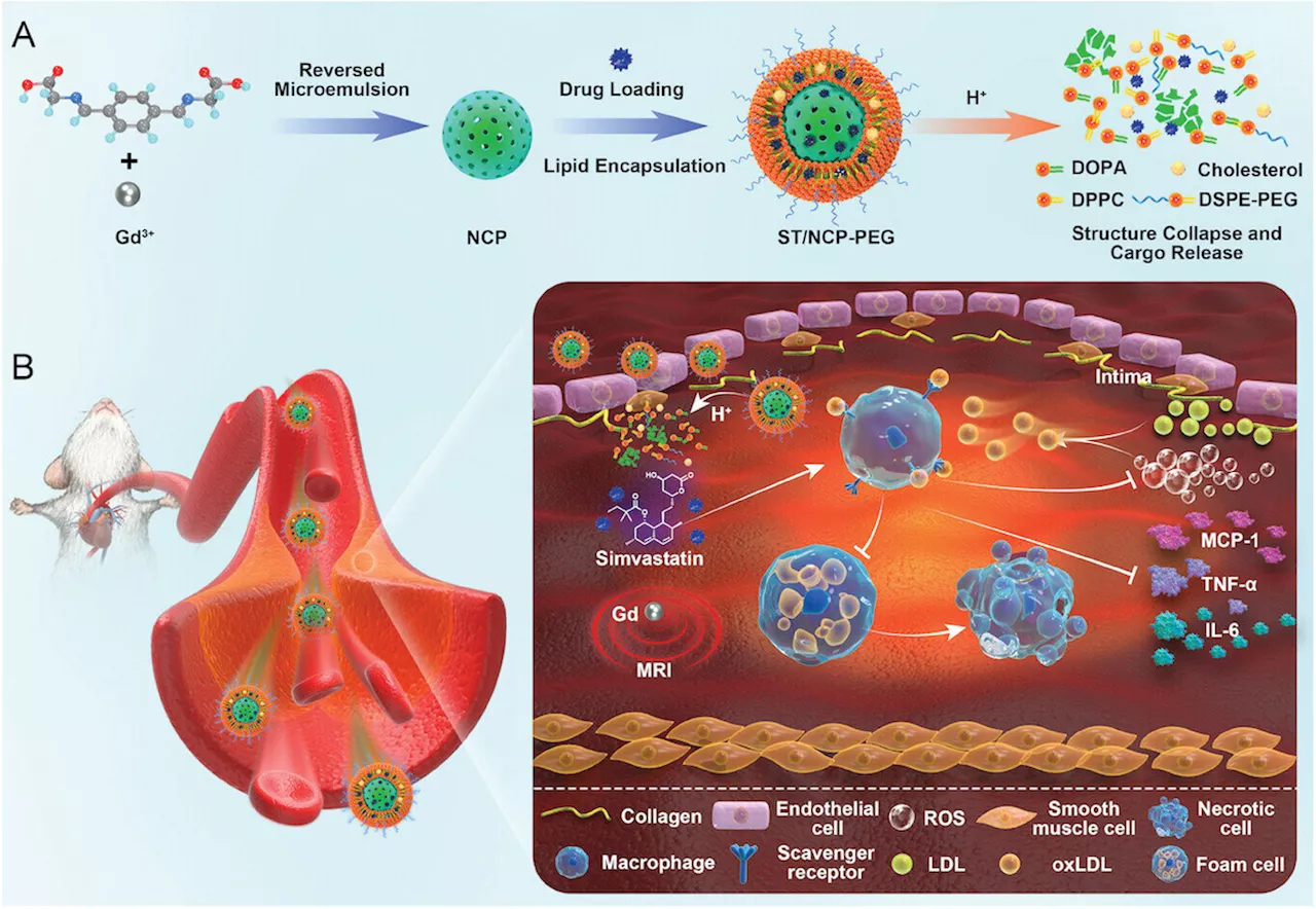 Nanoparticle technology shows promise for targeted diagnosis and treatment of atherosclerosis