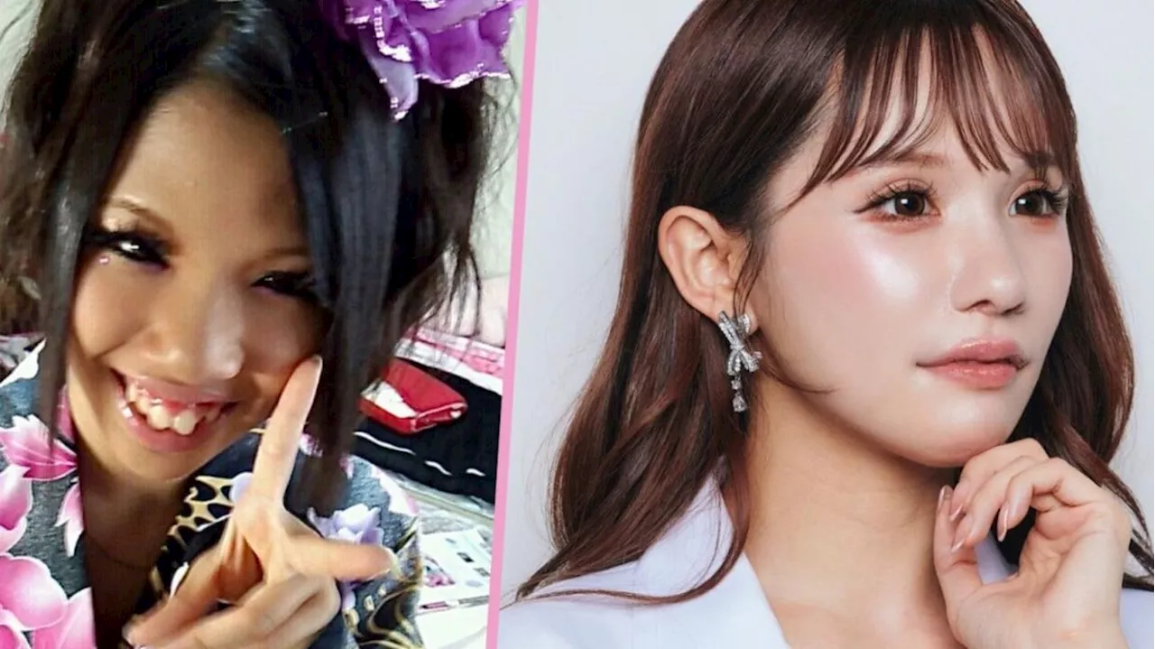 Japan influencer transforms look through extensive cosmetic surgery, gaining 1 million online fans