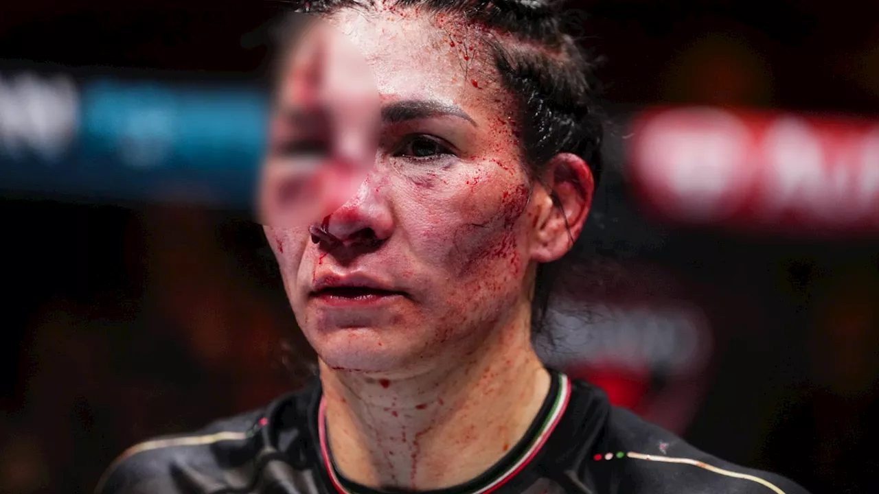 Former title challenger suffers ‘worst cut in UFC history’ in bloody battle on UFC 306 undercard...