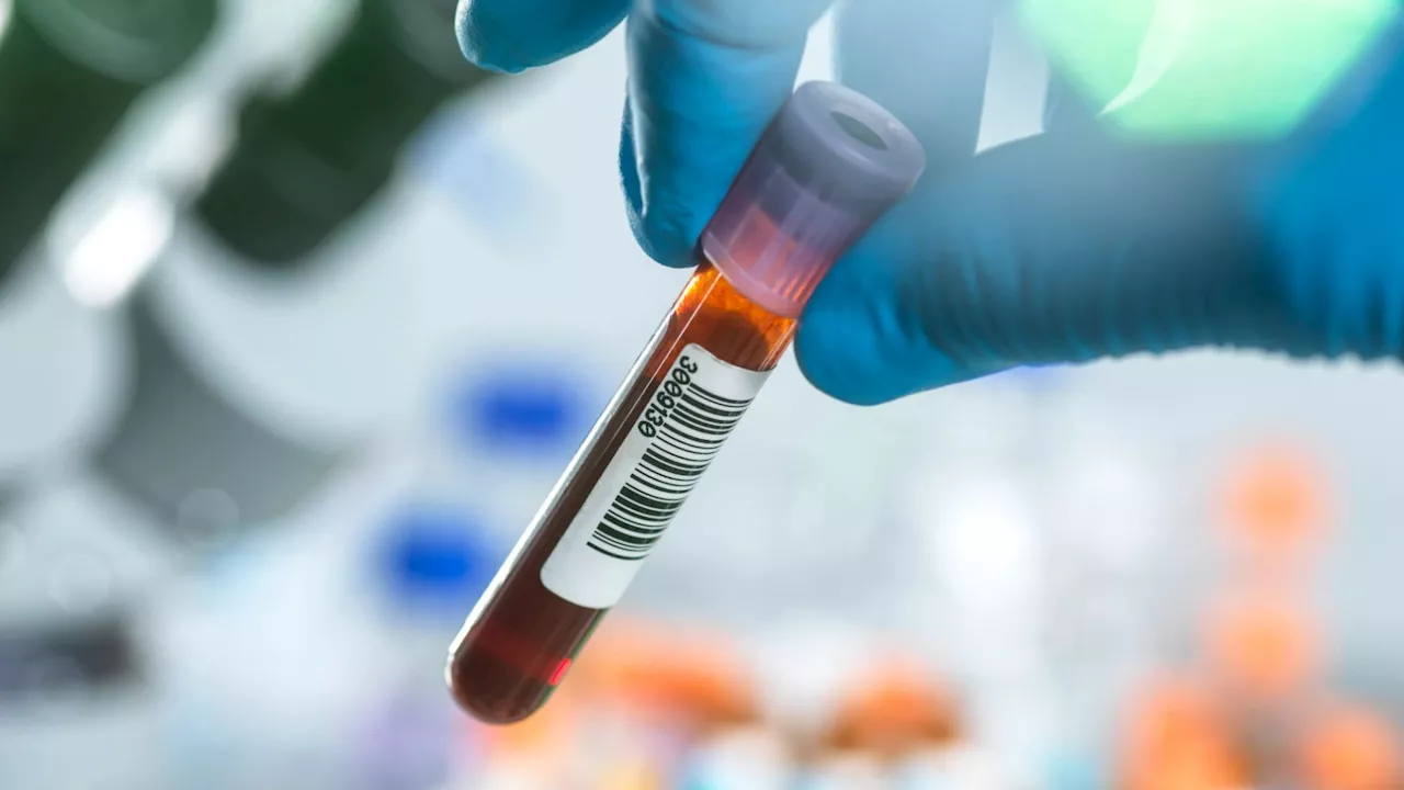 Breakthrough blood test could detect early stages of Alzheimer’s YEARS before symptoms show...