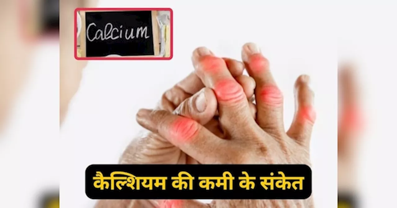 Calcium Deficiency: कैल्शियम की कमी होने पर शरीर इस तरह देता है इशारा, नजरअंदाज करना पड़ेगा भारी