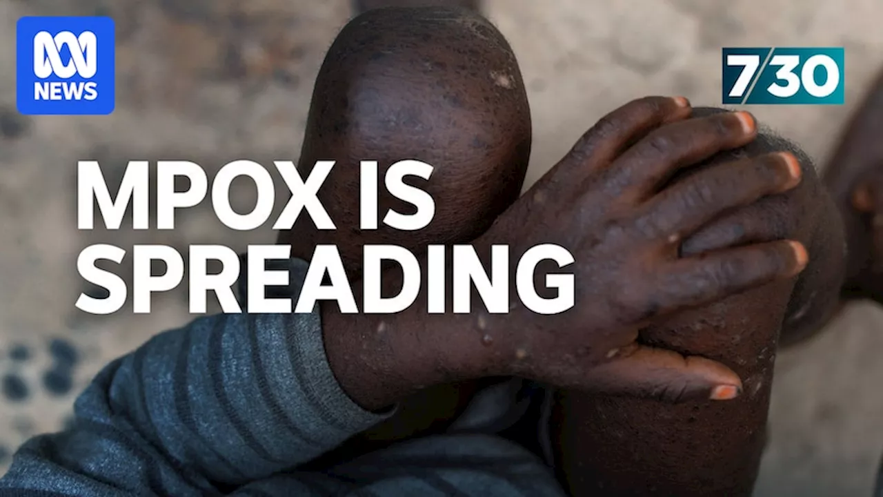 Calls for action on the worsening mpox outbreak