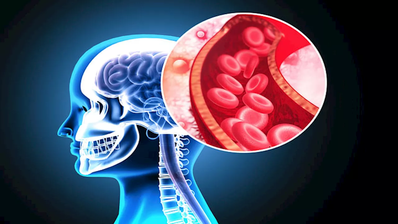 Stroke: युवाओं में बढ़ रहे हैं स्ट्रोक के मामले, इन लक्षणों की समय पर हो जाए पहचान तो बस सकती है जान