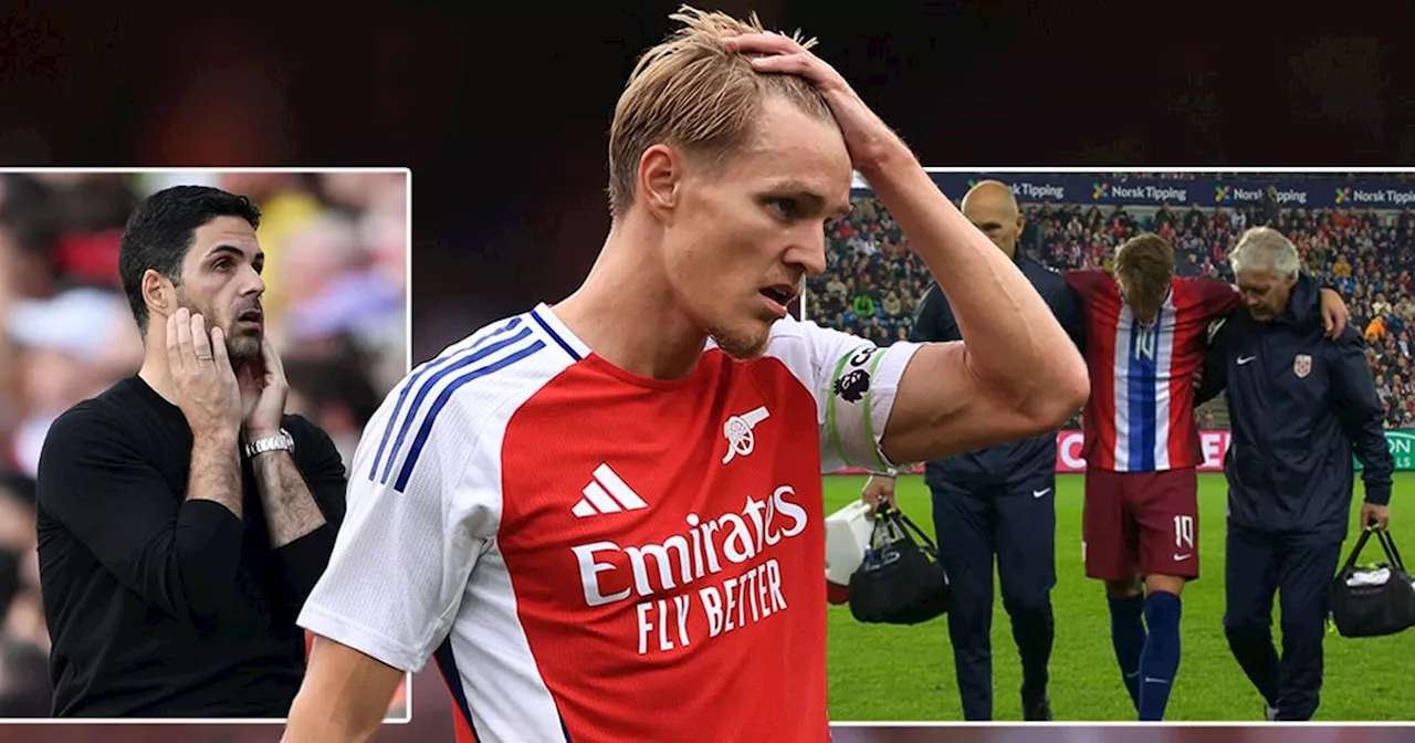 Every Arsenal game Odegaard will miss as timeline for injury absence emerges