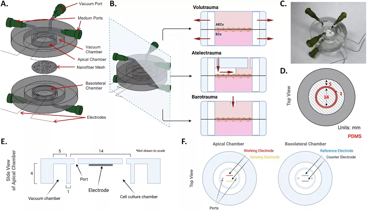 New ventilator-on-a-chip model enables real-time detection of lung injury at cellular level