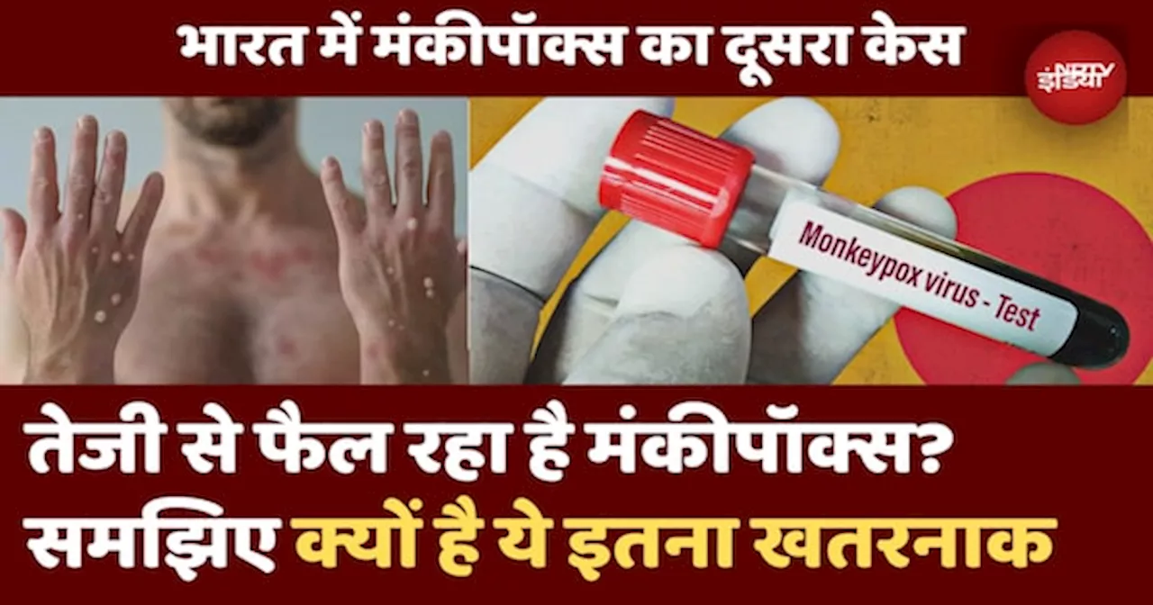 Mpox Virus: भारत में Monkeypox का दूसरा मामला | जानिए कितना हो सकता है खतरनाक | WHO