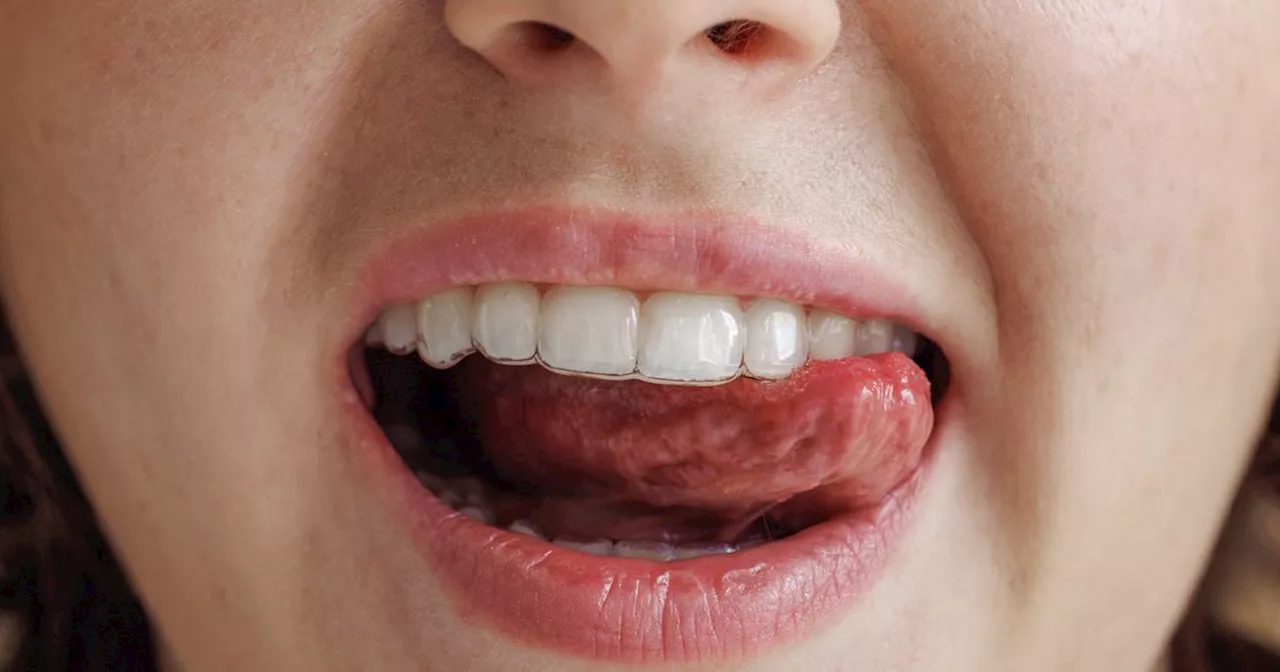 Do You Have A 'Scalloped Tongue'? Here's What It Says About Your Health.