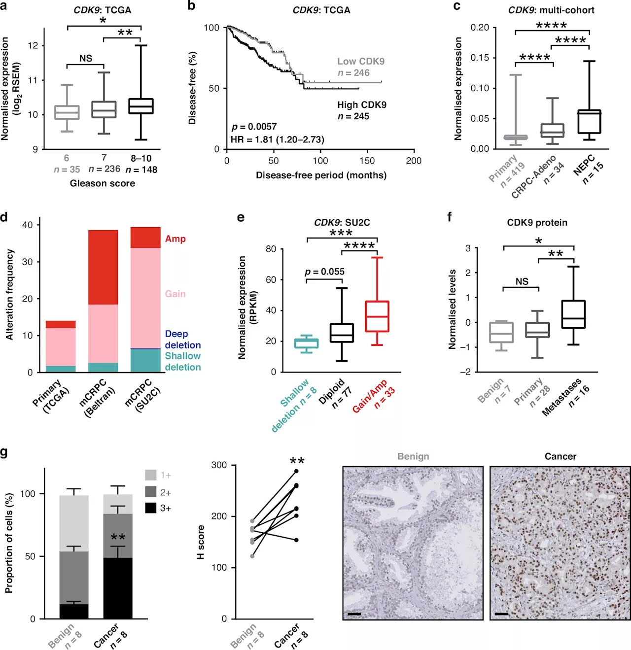 Proof-of-principle study uncovers promising treatment for incurable prostate cancer