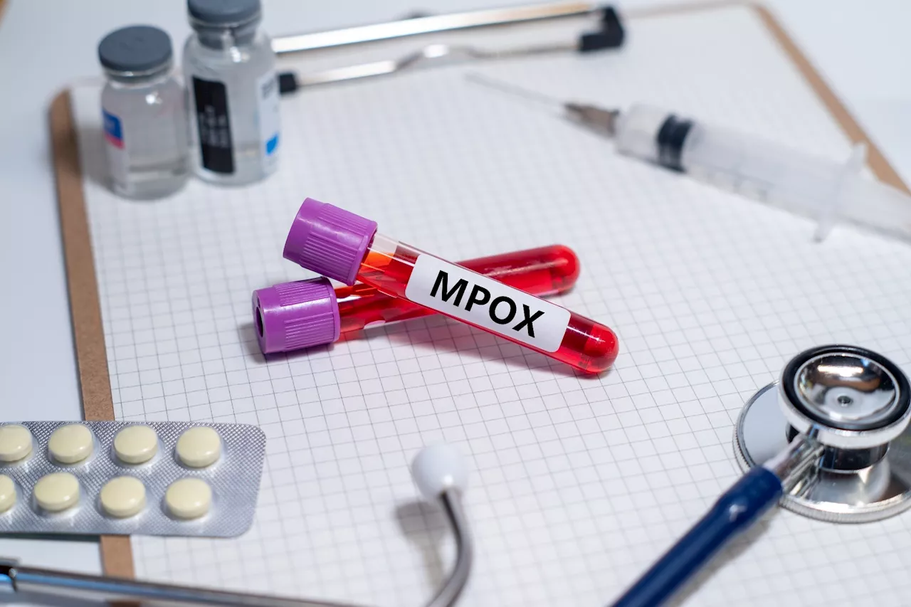 Study identifies key predictors of severe mpox cases