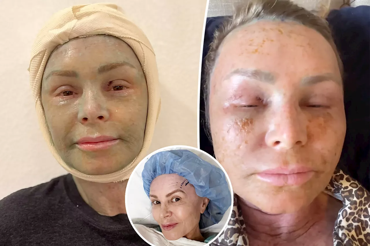 Tamra Judge shows major facial swelling after plastic surgery: 'Progress isn't always pretty'