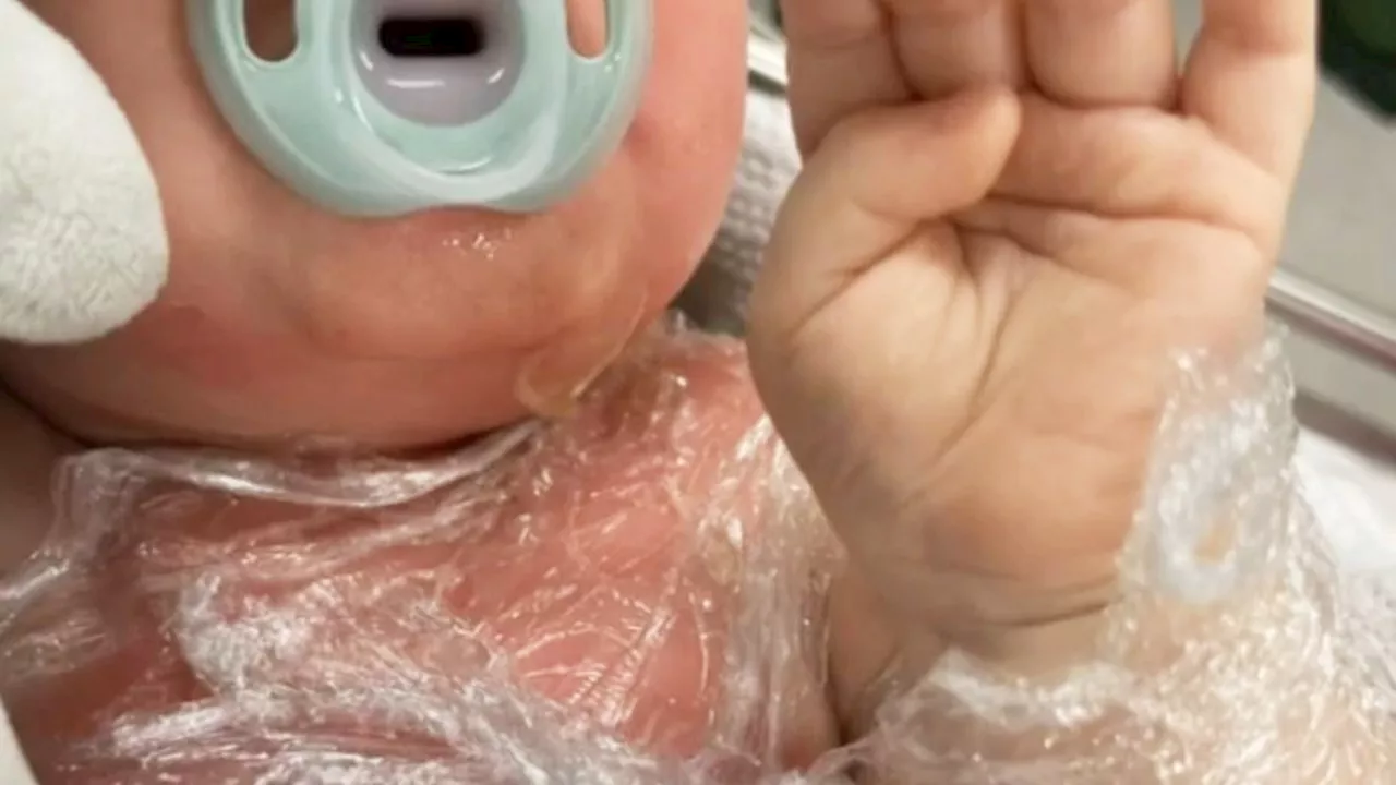 Heartwarming update on baby boy scalded by hot coffee