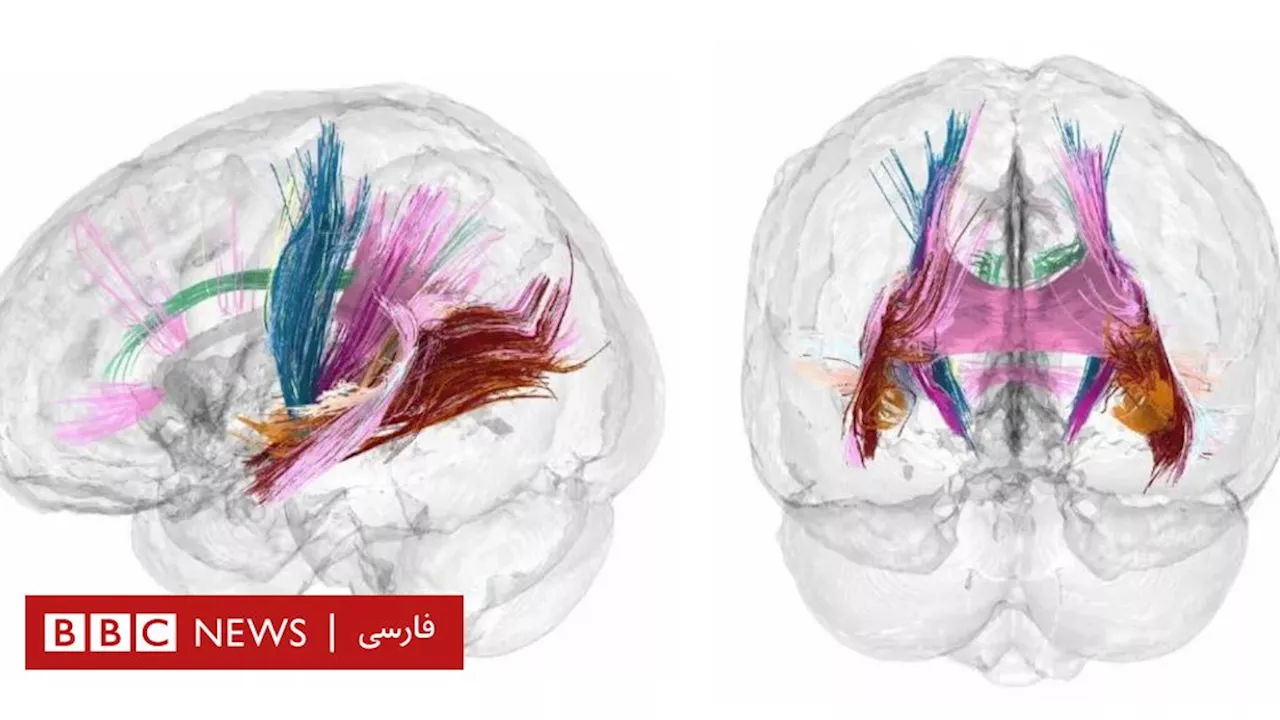 اسکن دقیق تغییرات مغز زنان در دوران بارداری را نشان می‌دهد