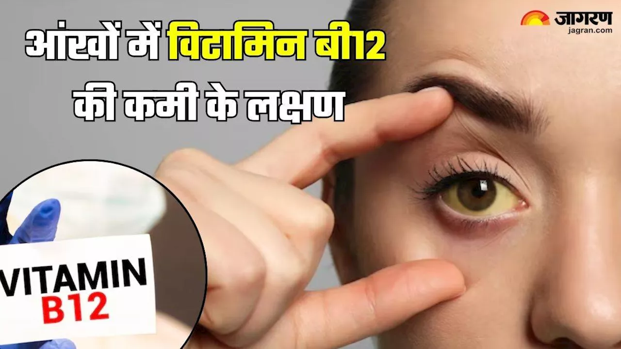 ड्राईनेस और जलन ही नहीं, शरीर में Vitamin B12 की कमी होने पर आंखों में नजर आते हैं ये 5 संकेत