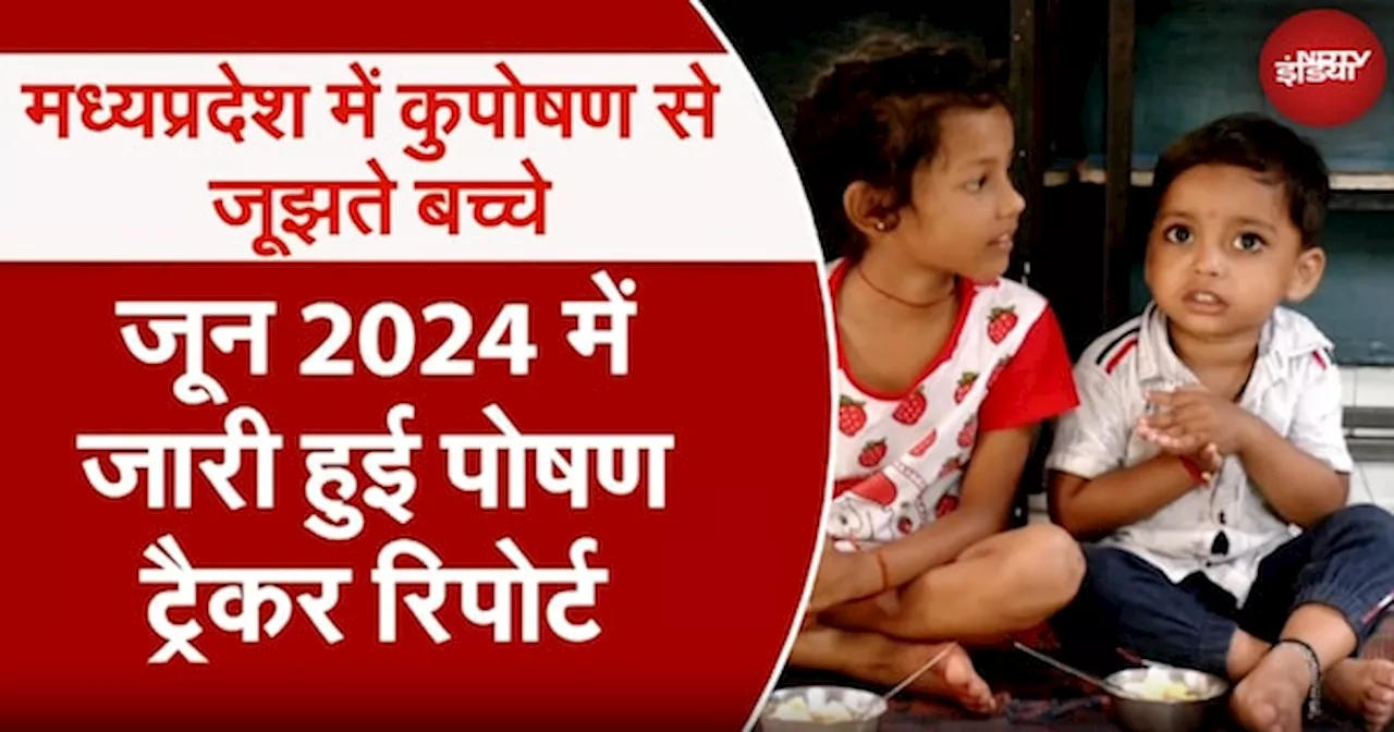 Malnutrition in MP: Madhya Pradesh में 1.36 लाख से अधिक बच्चे कुपोषण का शिकार हैं