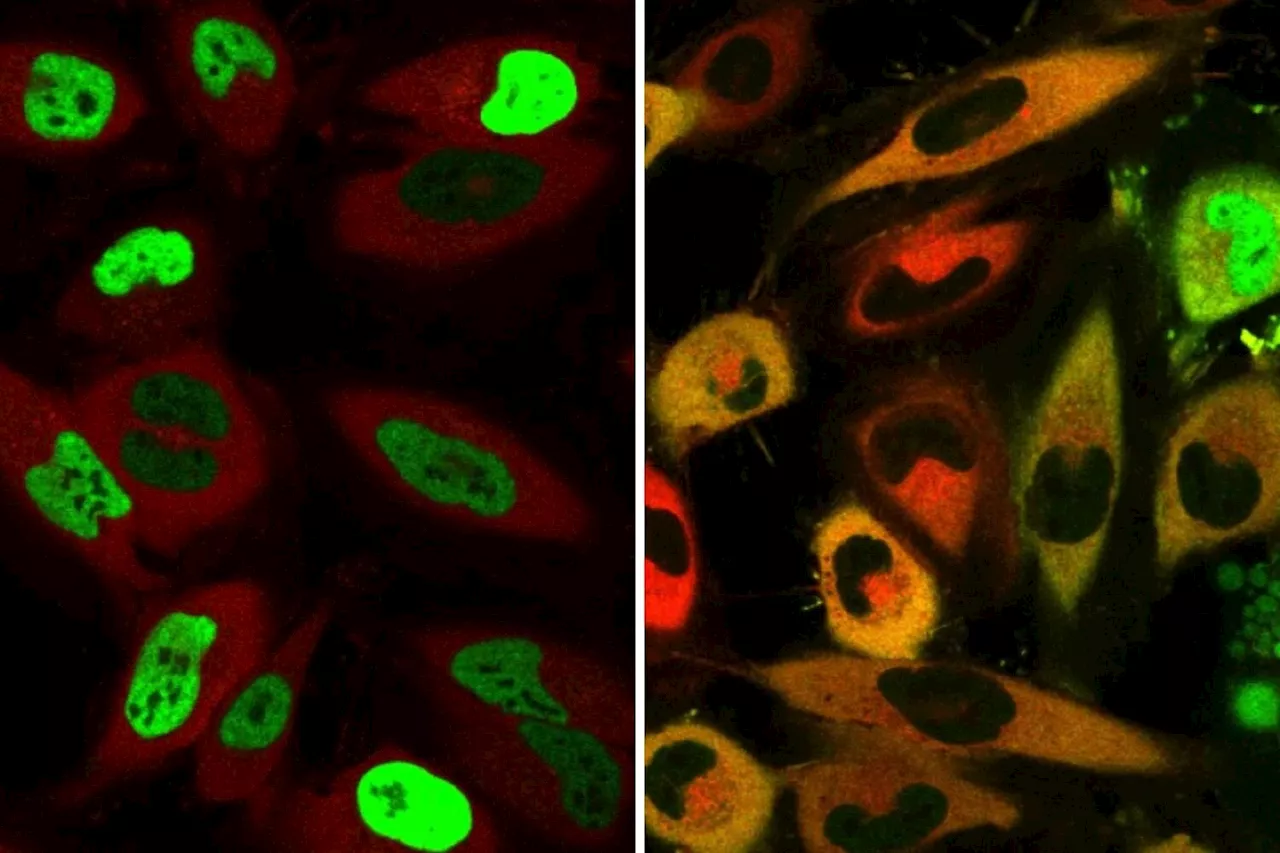 New method developed to relocate misplaced proteins in cells