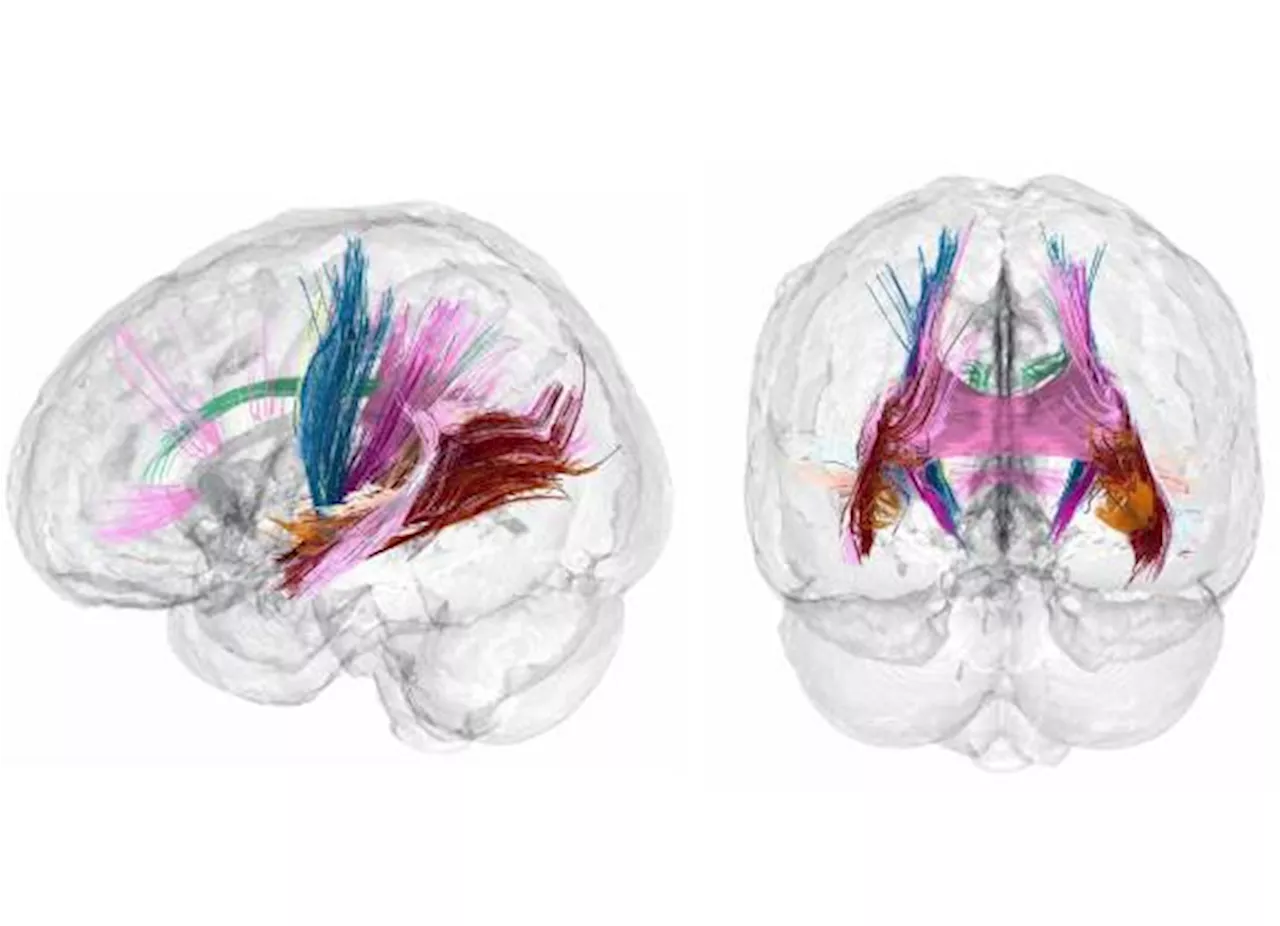 Surgen nuevas claves para determinar si el embarazo cambia el cerebro