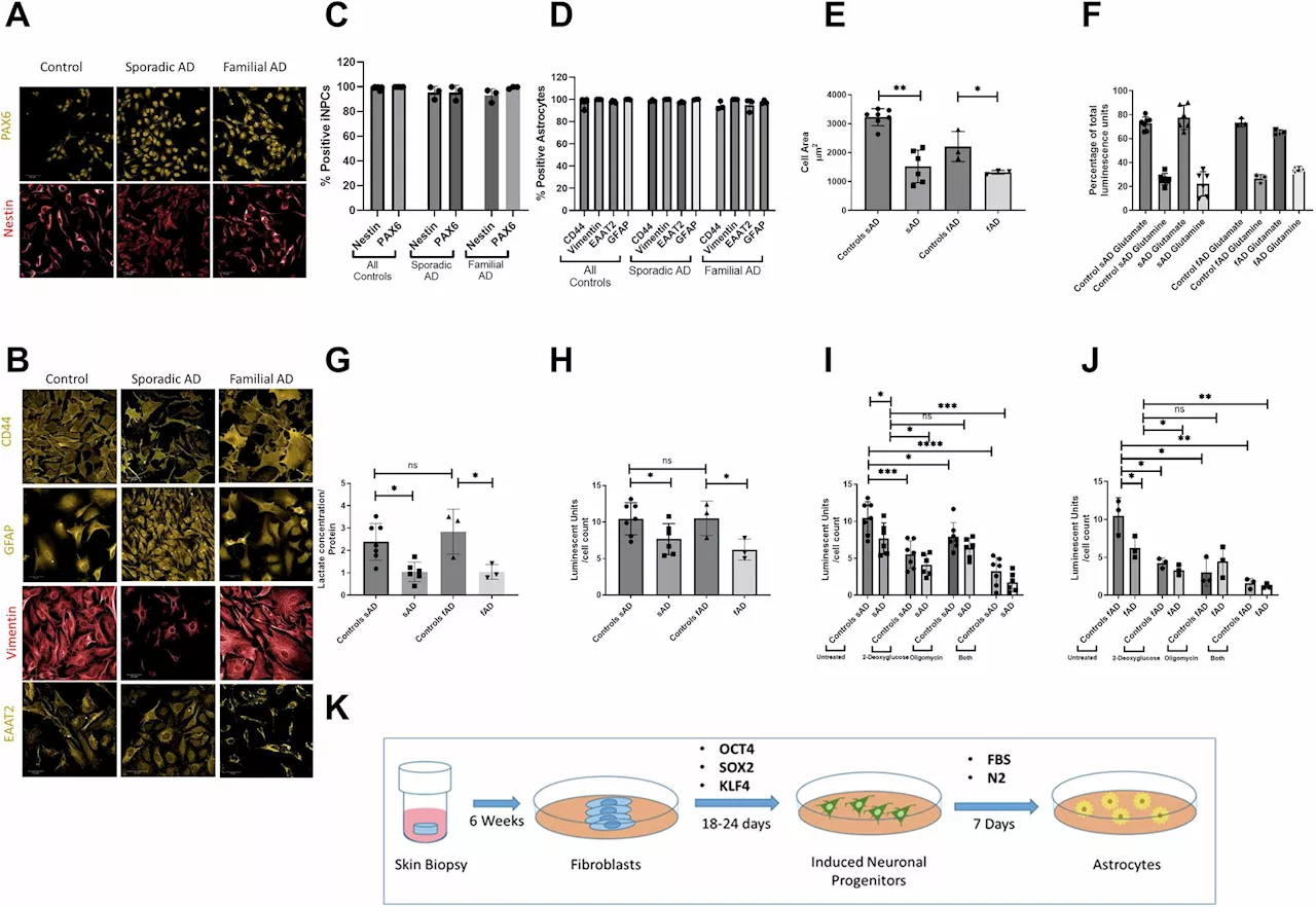 Astrocytes study identifies a new therapeutic target for Alzheimer's disease