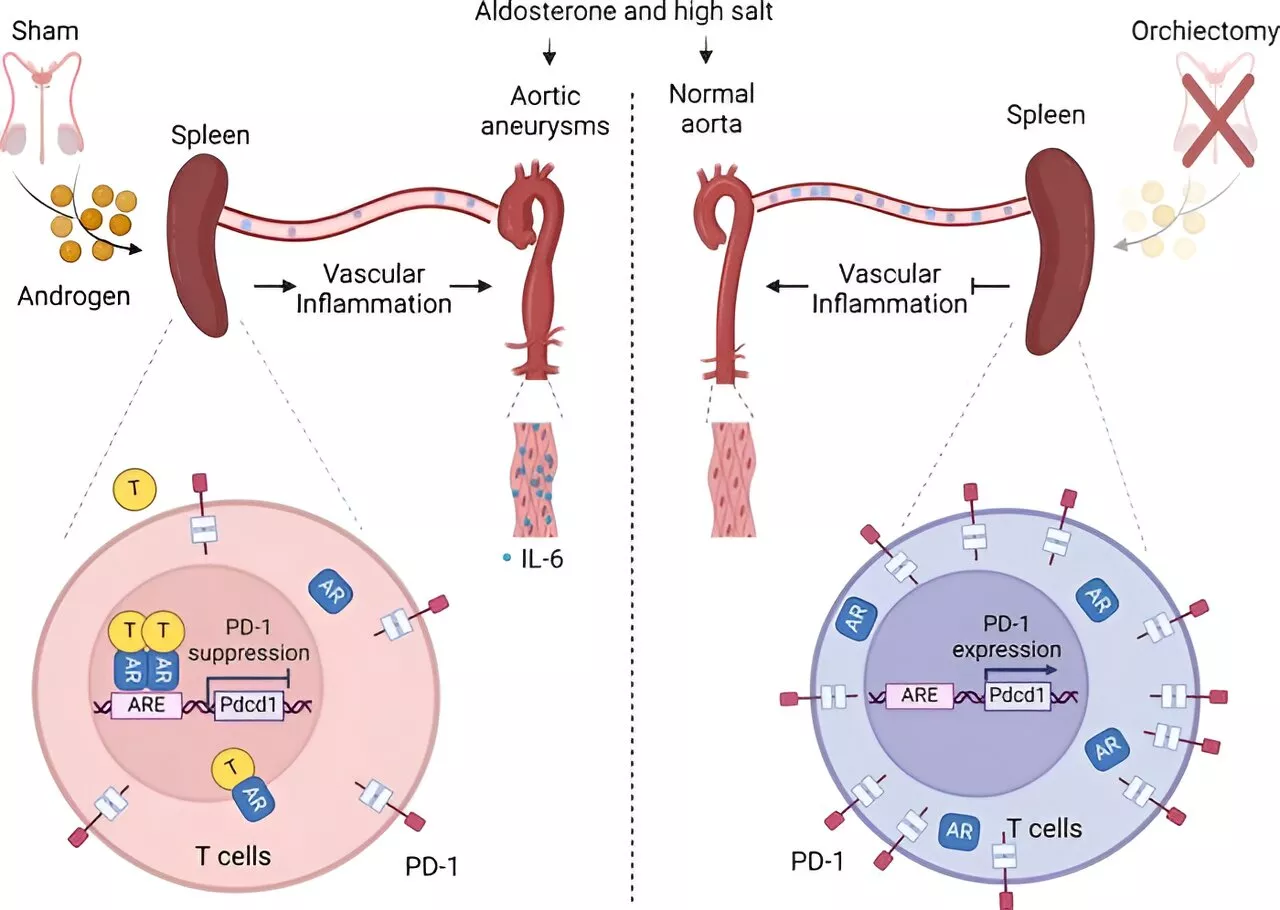 Understanding sex-specific differences in aortic aneurysms