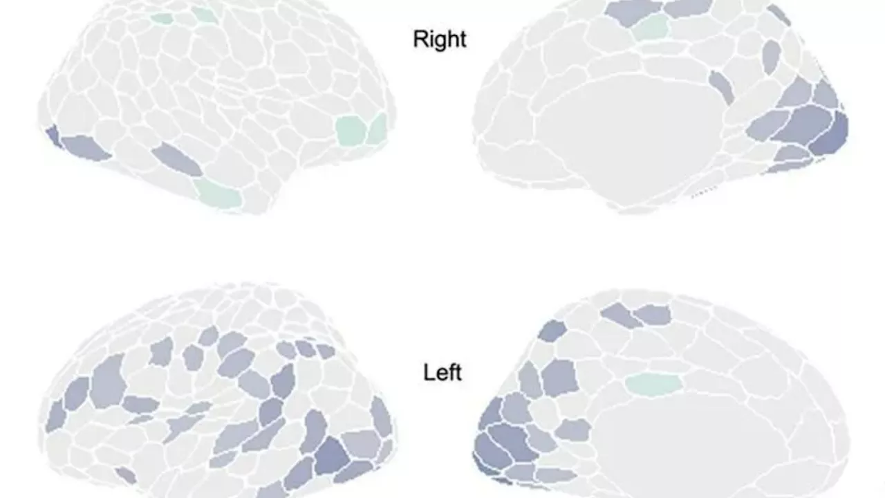 Men’s brains SHRINK by 8pm everyday – before resetting overnight, scientists discover...