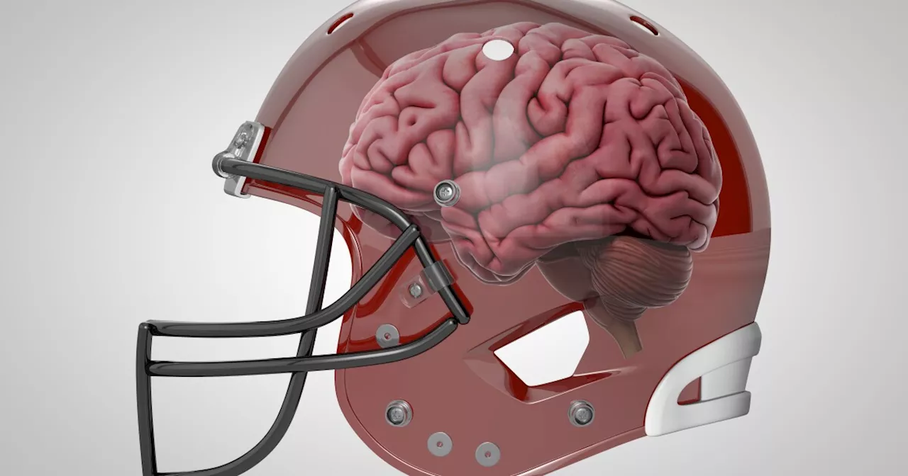 1 in 3 retired professional football players believe they have CTE, study finds