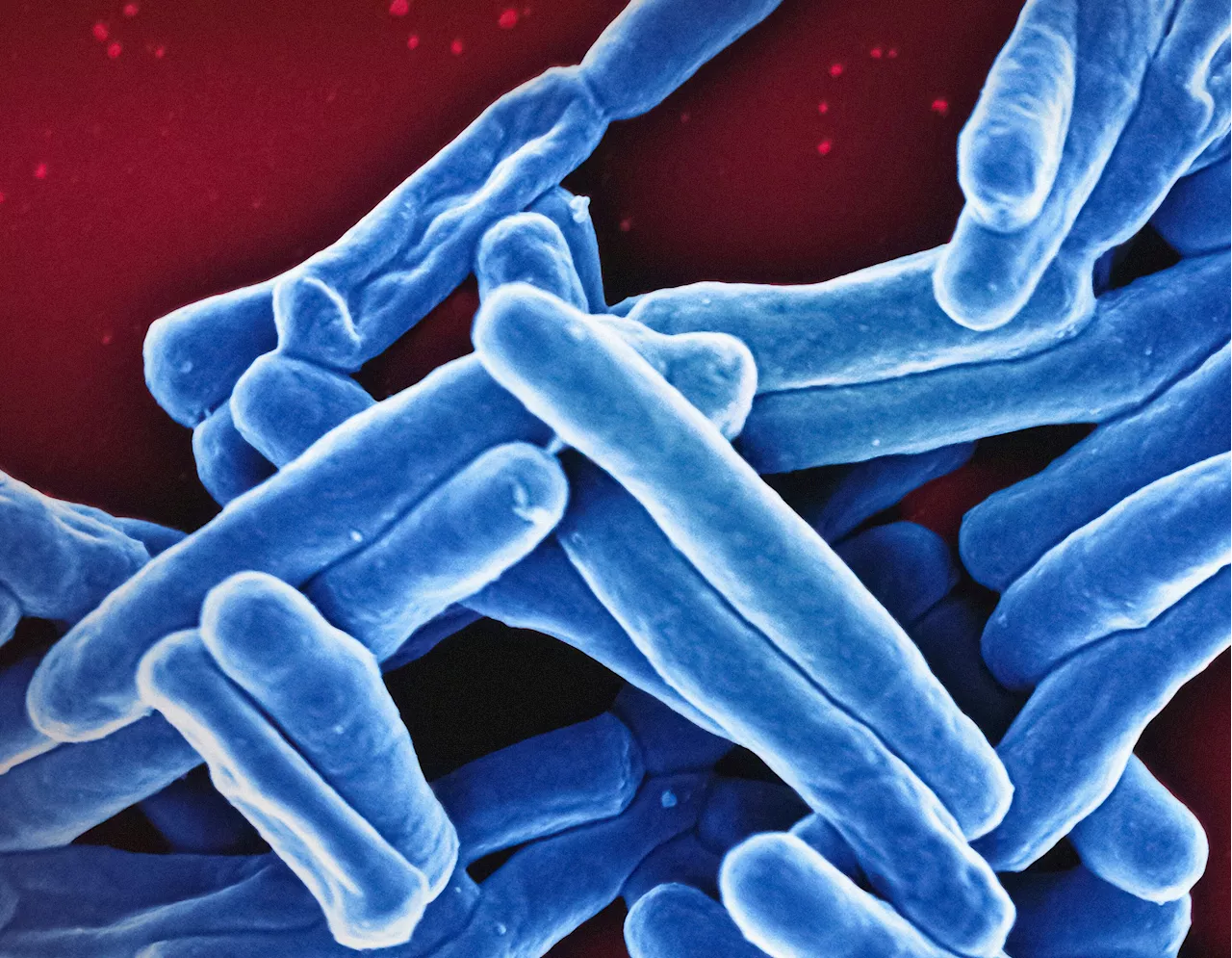 Tribbles protein offers hope for tuberculosis treatment