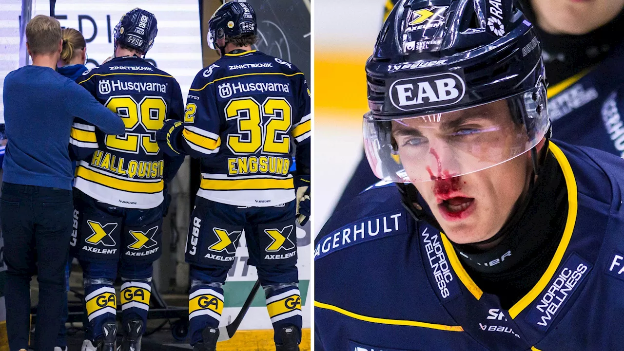 Ny skadesmäll för HV71 – skott i ansiktet