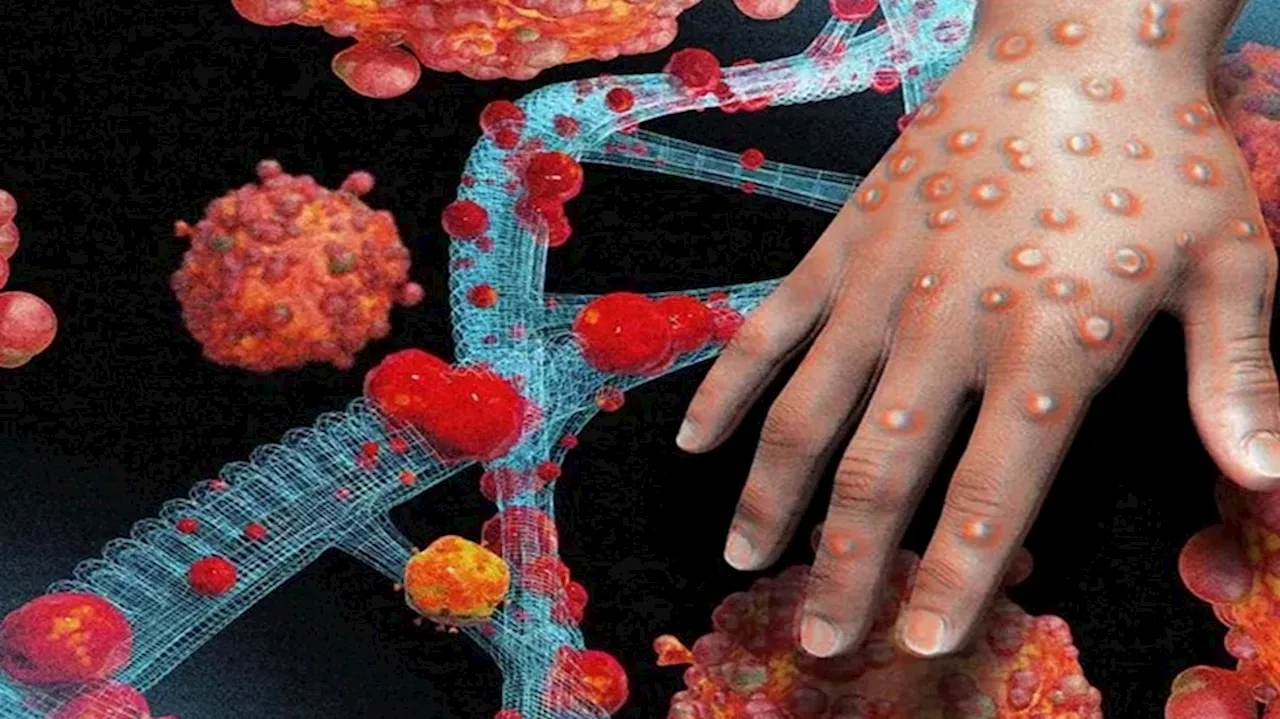 ಆಫ್ರಿಕಾದಲ್ಲಿ ಹಲ್‌ಚಲ್‌ ಸೃಷ್ಟಿಸಿರುವ MPox ವೈರಸ್‌ನ ಈ ಅಪಾಯಕಾರಿ ವೇರಿಯಂಟ್ ಭಾರತವನ್ನು ಪ್ರವೇಶಿಸಿದೆ