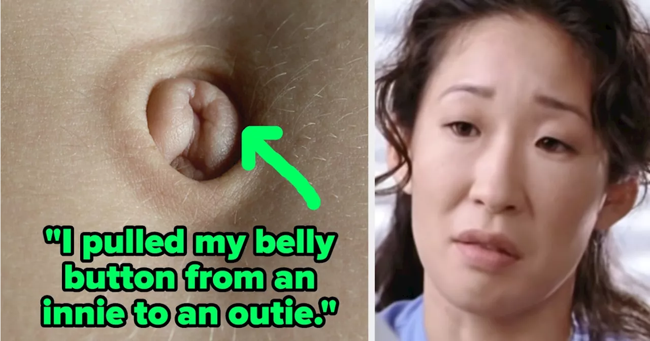 39 People Shared Their Most Shocking Body 'Abnormalities' And It's Really, Really, Really, Really Fascinating