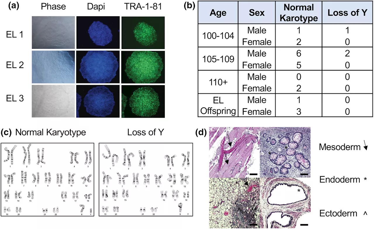 Researchers establish largest stem cell repository focused on centenarians