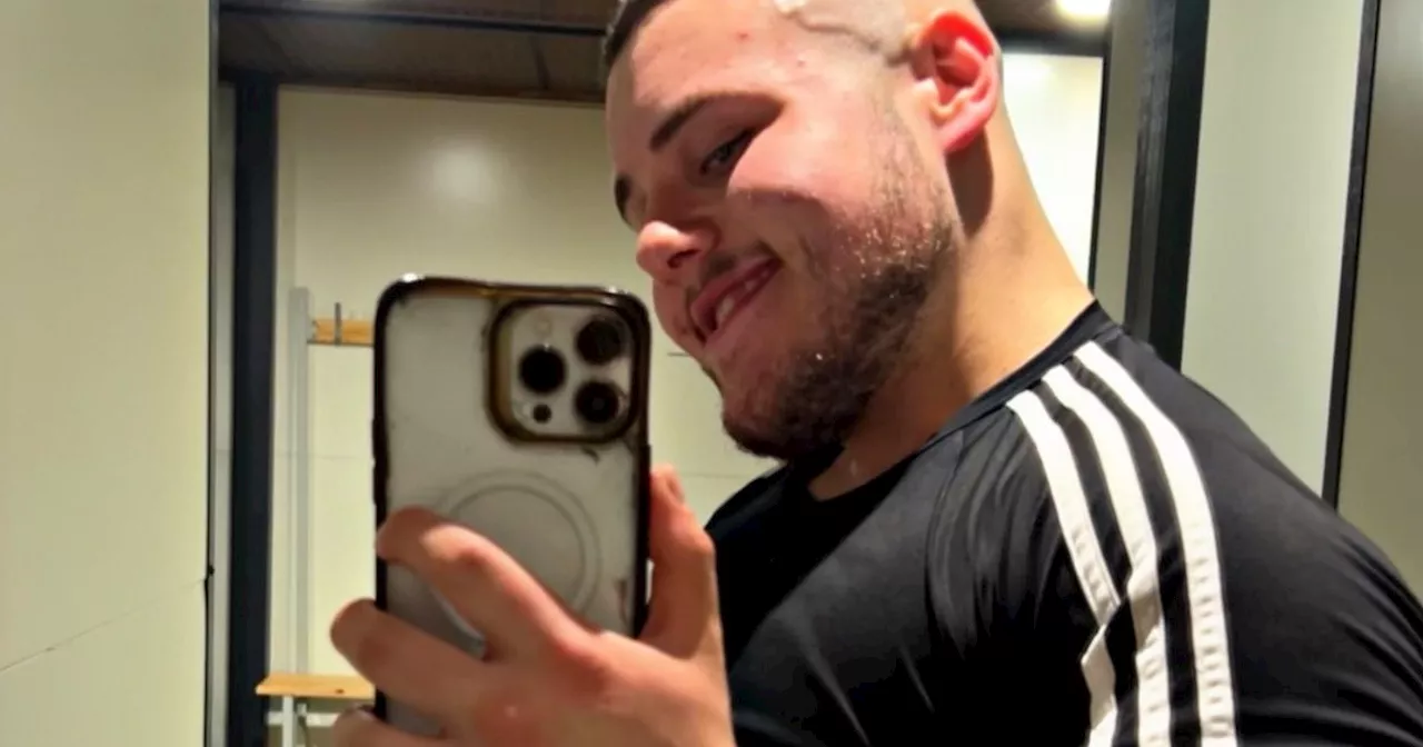 Man lost staggering 14 stone after weighing 28 stone as a teen