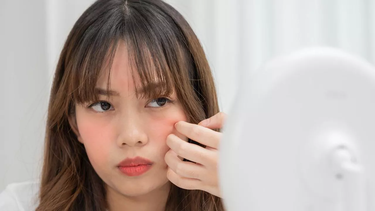 10 Tips Meredakan Kemerahan pada Kulit Wajah, Rekomendasi Dermatolog yang Mudah Dilakukan!