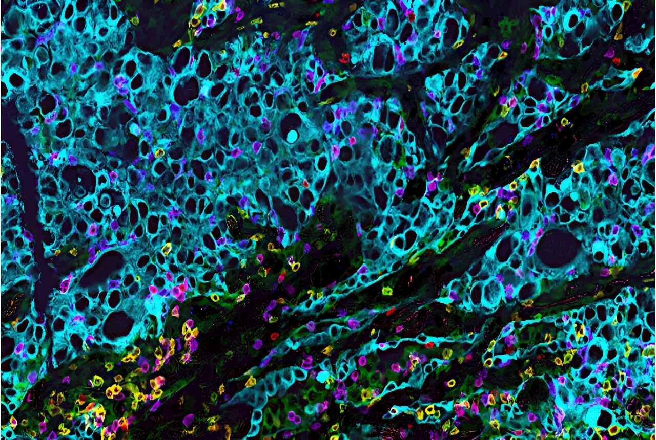 Metabolic reprogramming of T cells may enhance checkpoint inhibitor therapy