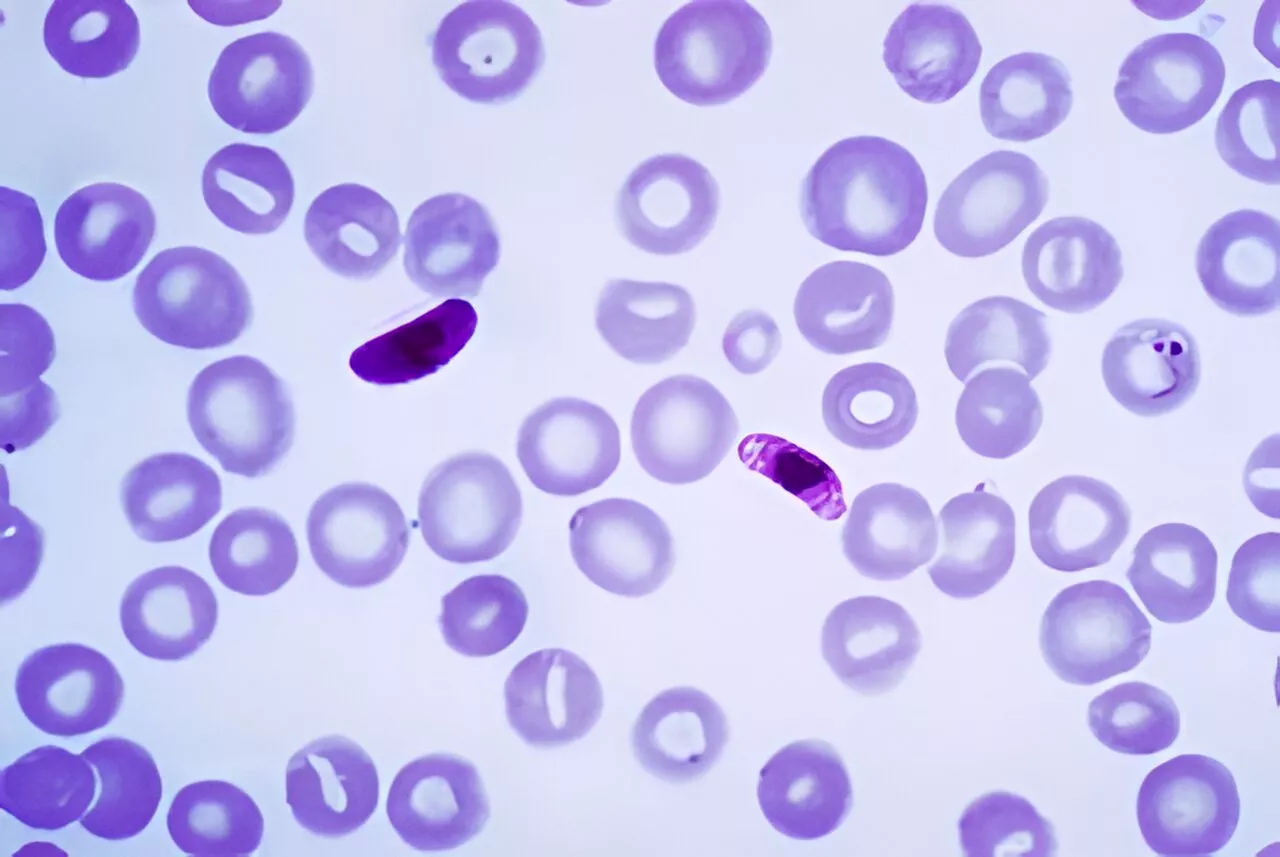 Synthetic compound shows promise against drug-sensitive, drug-resistant strains of human malaria parasites