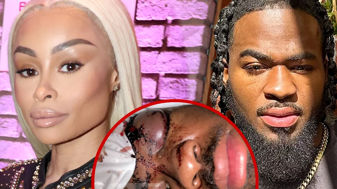 Blac Chyna Sued For Violent Attack on Ex-Boyfriend