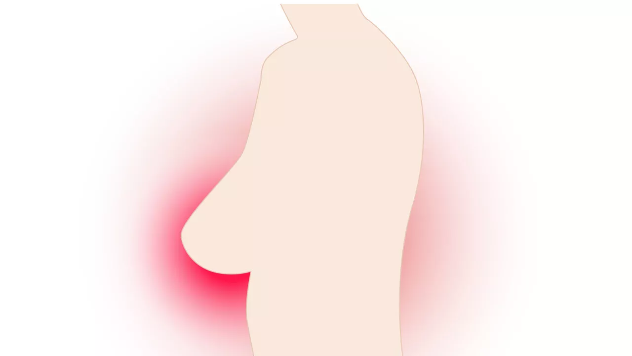 Noduli al seno: come riconoscerli (e quando sono pericolosi)