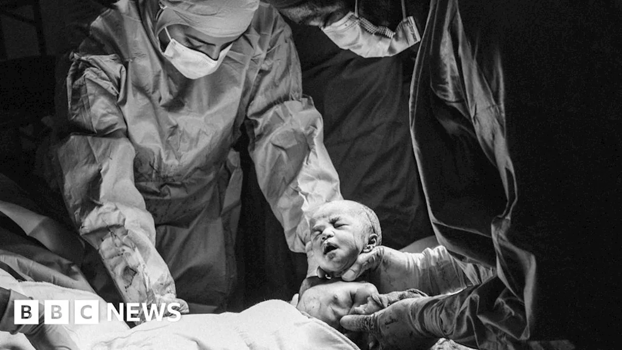 Childbirth experiences at maternity unit captured by photographer