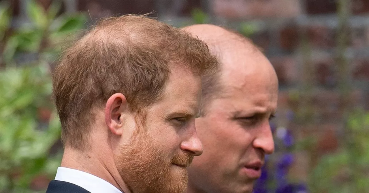 Are Prince William and Harry considering hair transplants?