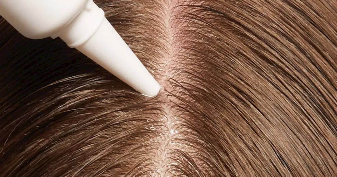 Shoppers say scalp serum 'immediately' soothes irritated and itchy scalp